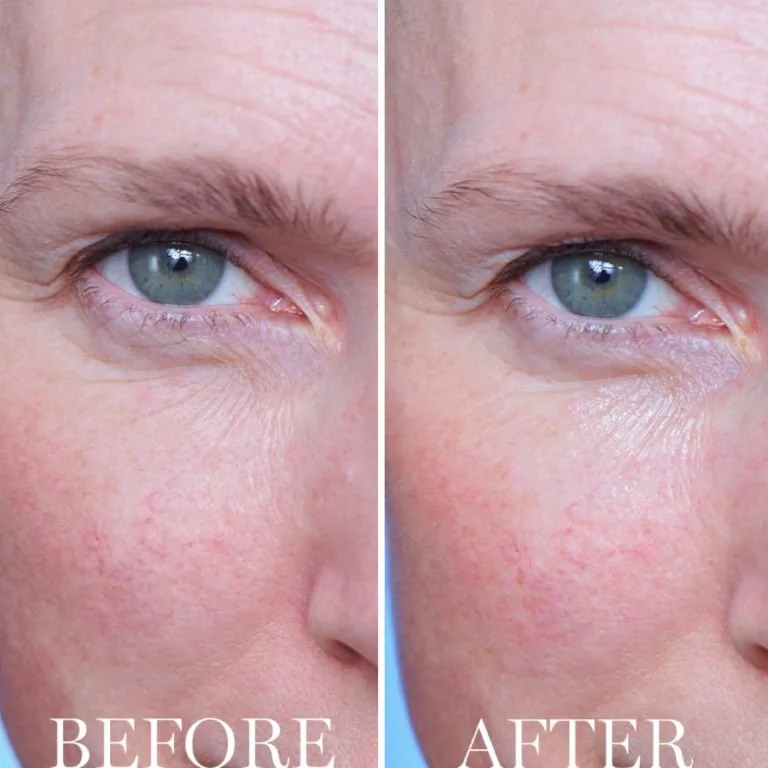 Advanced Génifique Eye Cream thumbnail 5